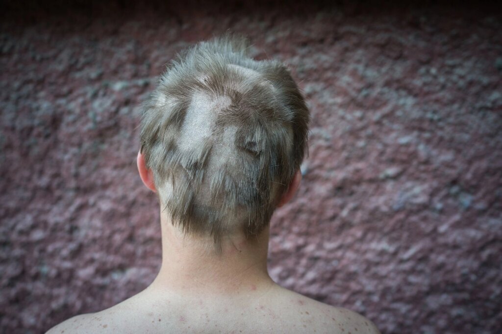 back of someone's head with a bad haircut